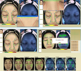 3d Dermatology Facial Skin Analysis Machine เครื่องสแกนใบหน้า Skin Analyzer 40W